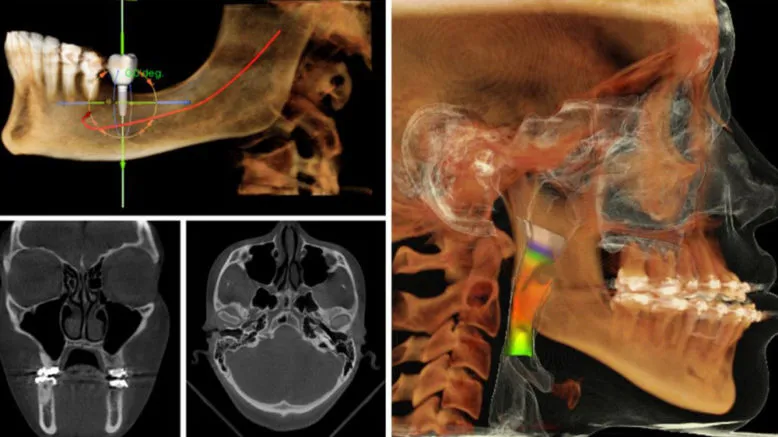 Ph.D. in Oral Medicine and Radiology: Introduction, Admission, Registration, Eligibility, Duration, Fees, Syllabus 2024